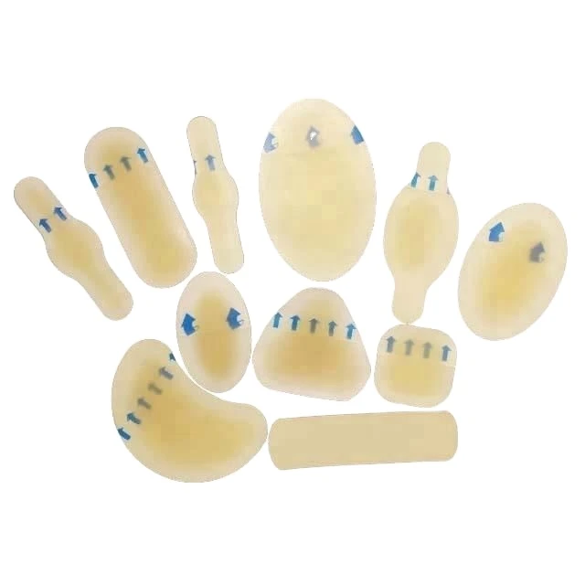 Hydrocolloid Dressing